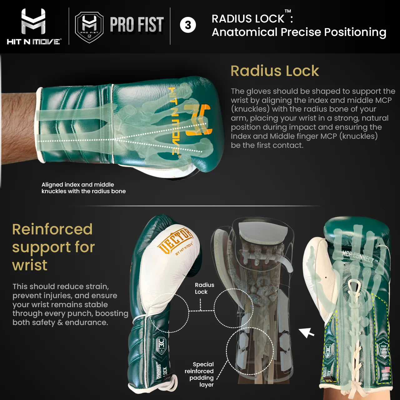 Radius Lock™ : Anatomical Precise Positioning